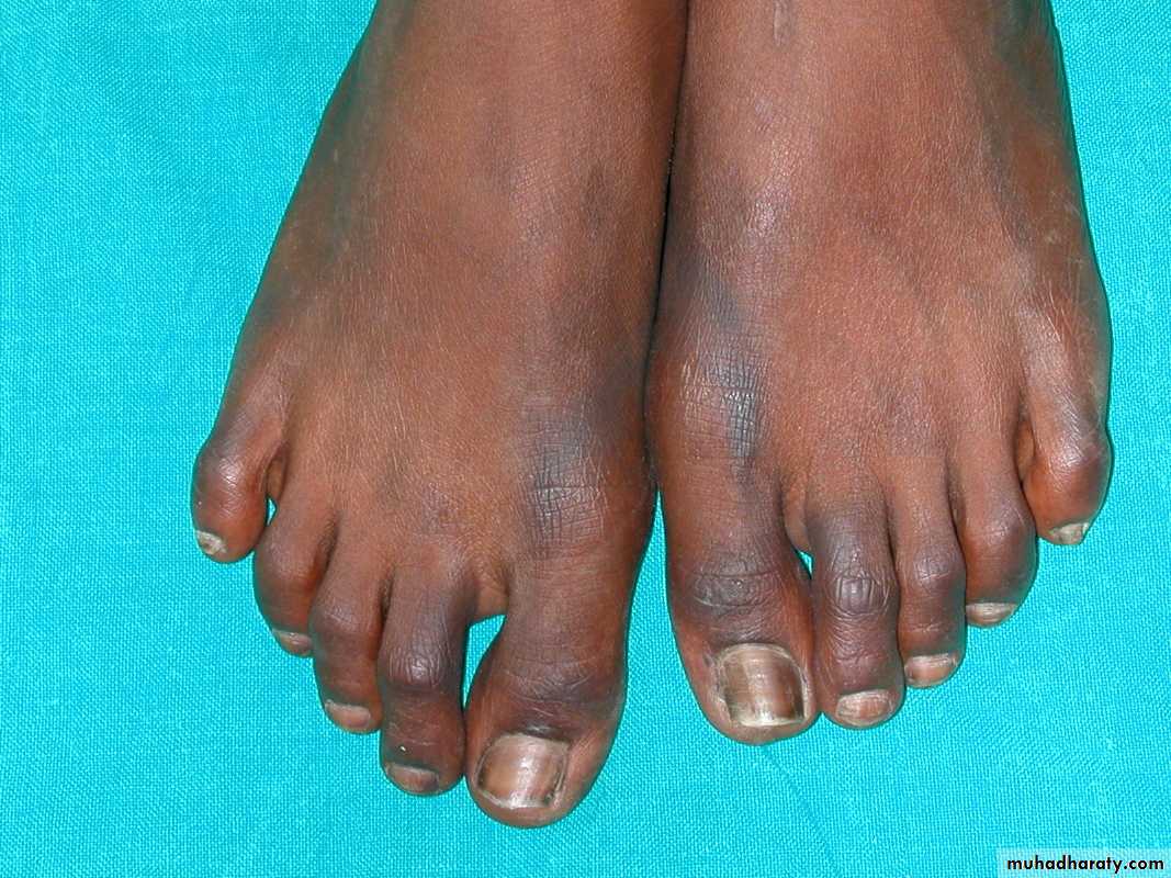 Manifestations of Systemic Diseases