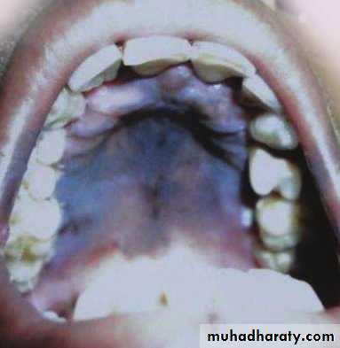 Manifestations of Systemic Diseases
