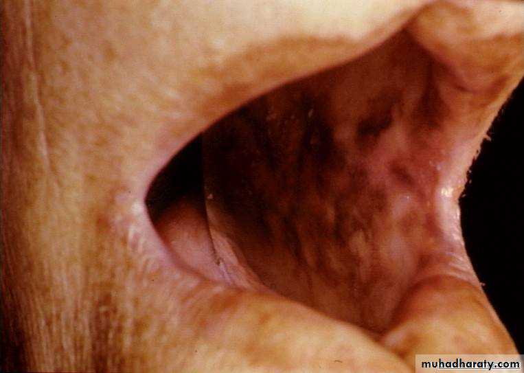 Manifestations of Systemic Diseases