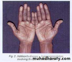 Manifestations of Systemic Diseases