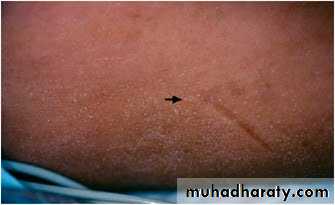 Manifestations of Systemic Diseases