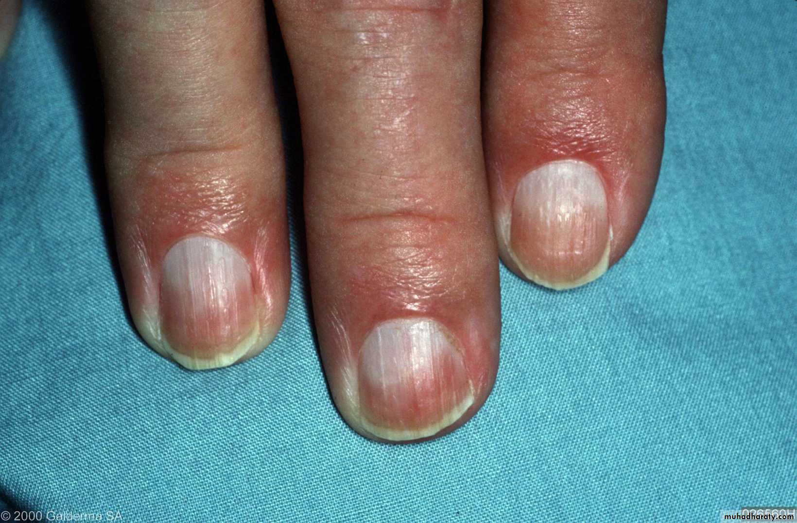 Manifestations of Systemic Diseases