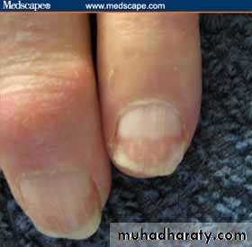Manifestations of Systemic Diseases