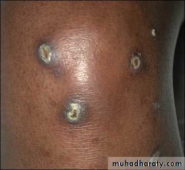 Manifestations of Systemic Diseases
