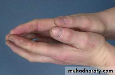 Manifestations of Systemic Diseases
