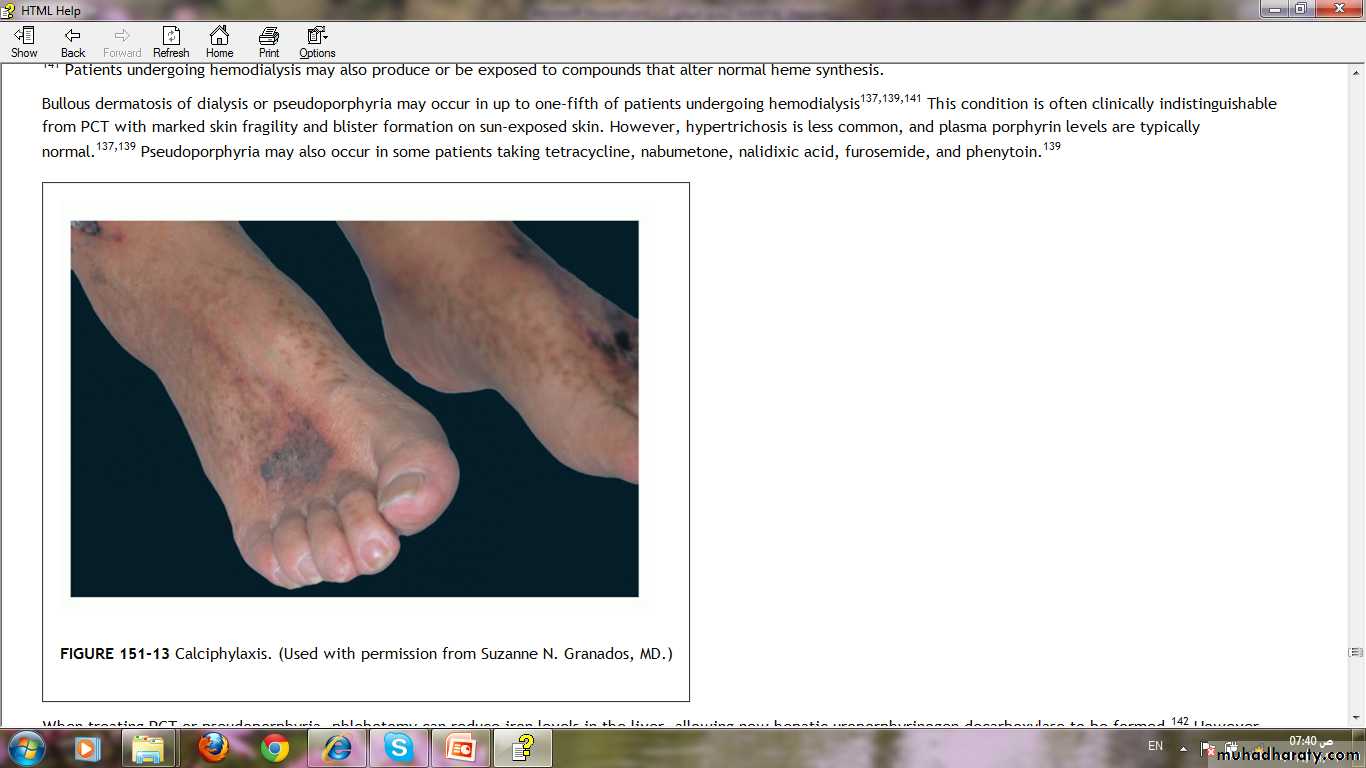 Manifestations of Systemic Diseases