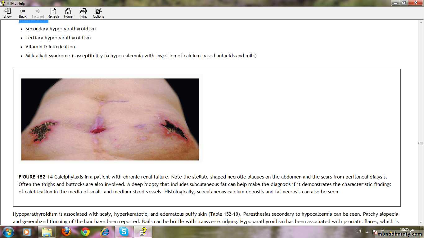 Manifestations of Systemic Diseases