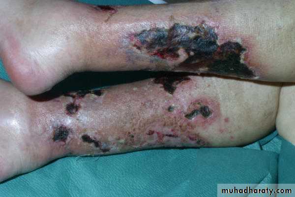 Manifestations of Systemic Diseases
