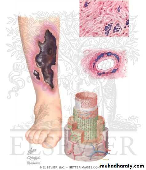 Manifestations of Systemic Diseases