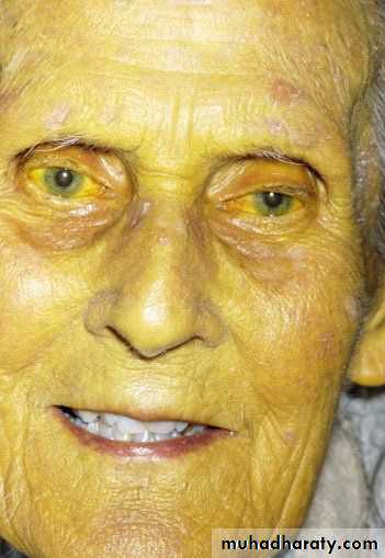 Manifestations of Systemic Diseases