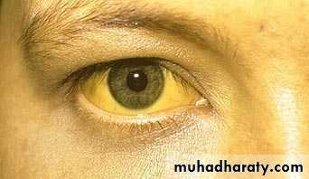 Manifestations of Systemic Diseases