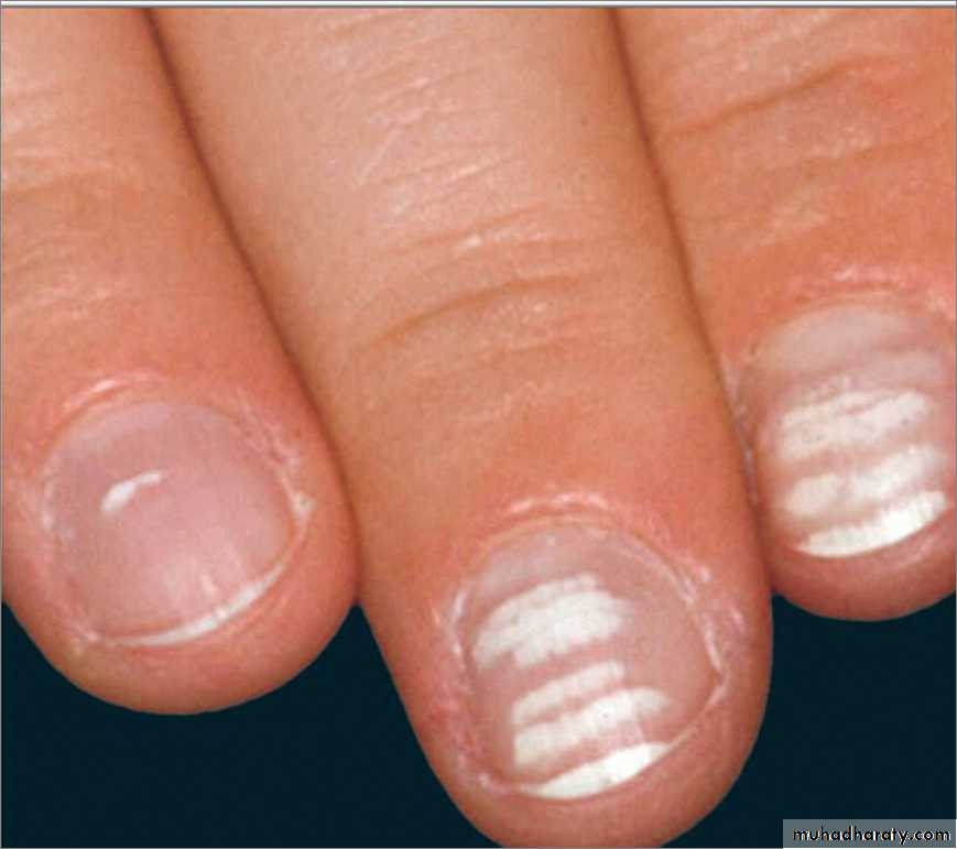 Manifestations of Systemic Diseases