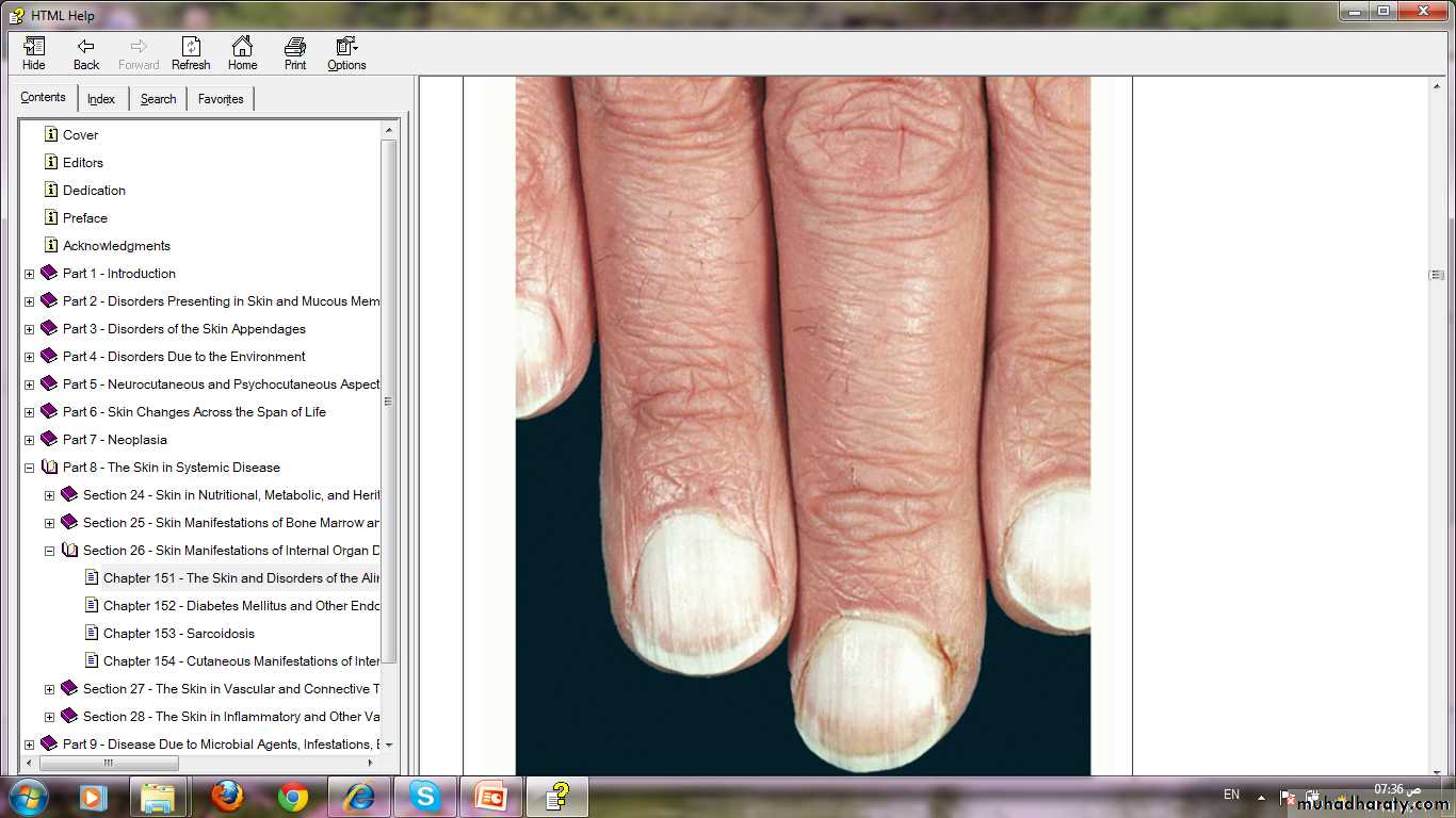 Manifestations of Systemic Diseases
