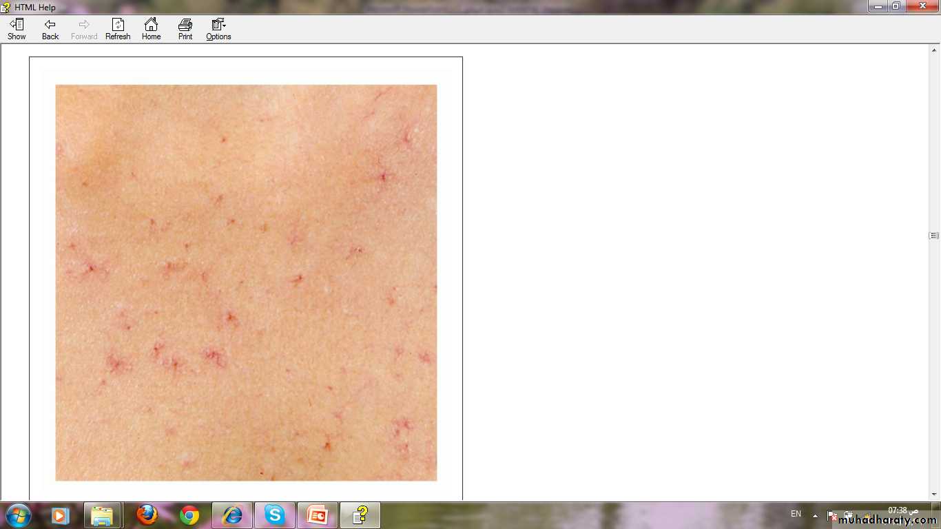 Manifestations of Systemic Diseases