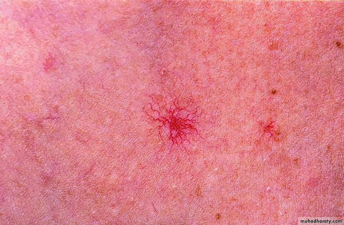 Manifestations of Systemic Diseases