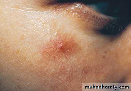 Manifestations of Systemic Diseases