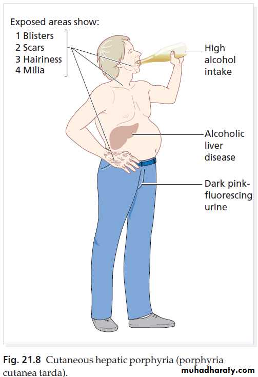 Manifestations of Systemic Diseases