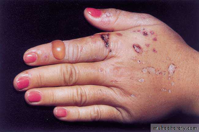 Manifestations of Systemic Diseases