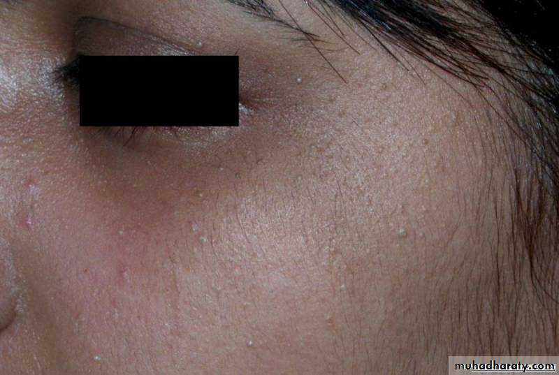 Manifestations of Systemic Diseases