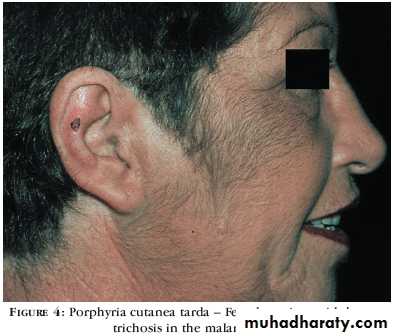 Manifestations of Systemic Diseases