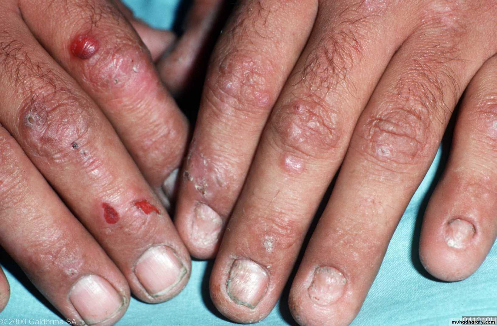 Manifestations of Systemic Diseases
