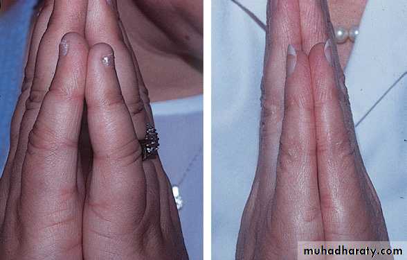 Manifestations of Systemic Diseases