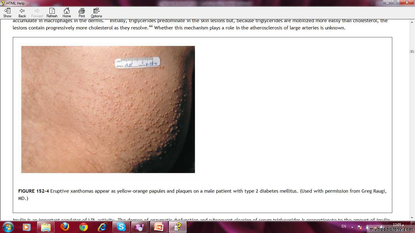 Manifestations of Systemic Diseases