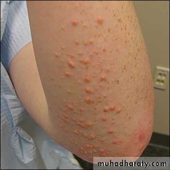 Manifestations of Systemic Diseases