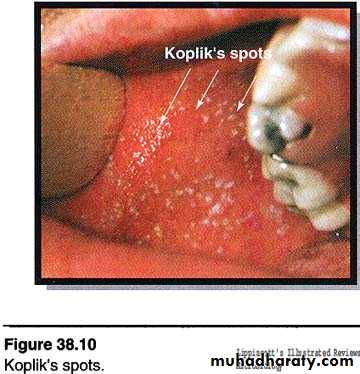 Paramyxoviruses
