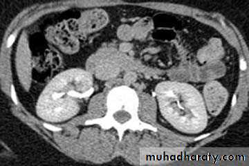Genito-urinary System