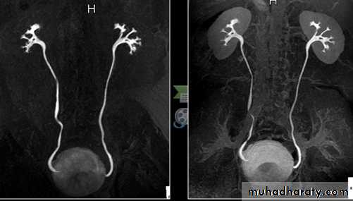 Genito-urinary System