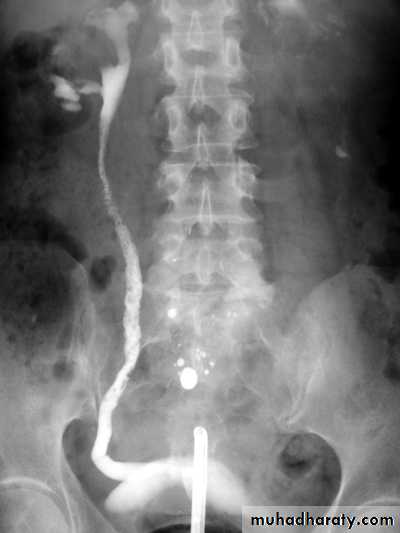 Genito-urinary System