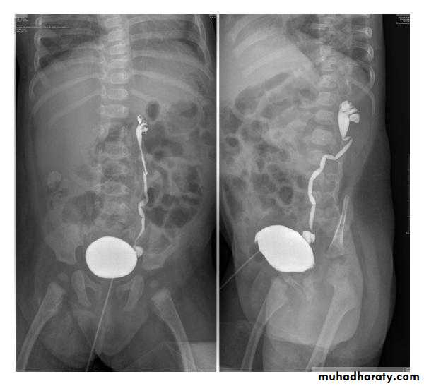 Genito-urinary System