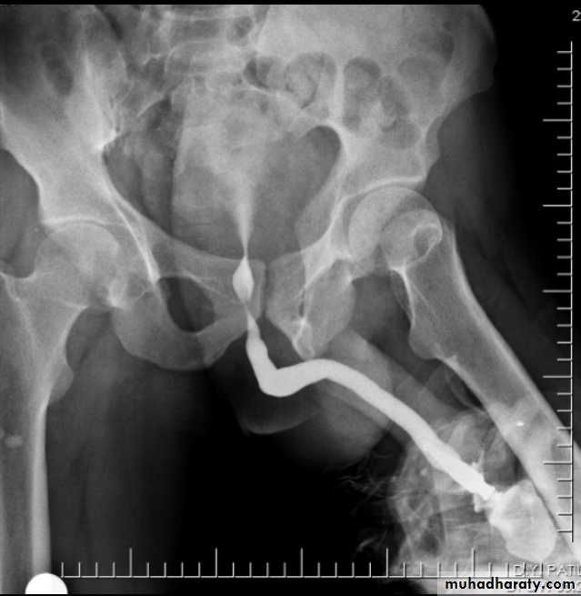 Genito-urinary System