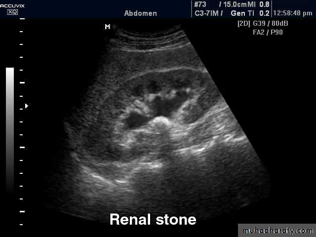 Genito-urinary System