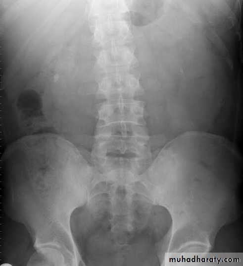 Genito-urinary System