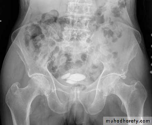Genito-urinary System