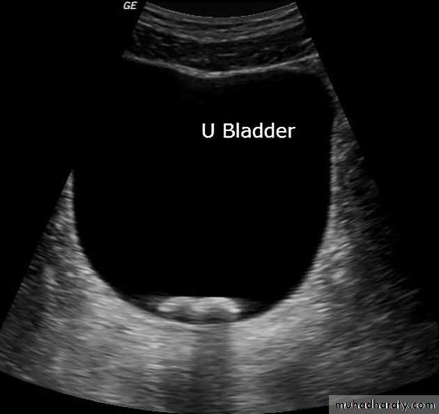 Genito-urinary System