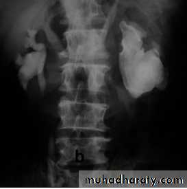 Genito-urinary System