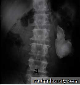 Genito-urinary System