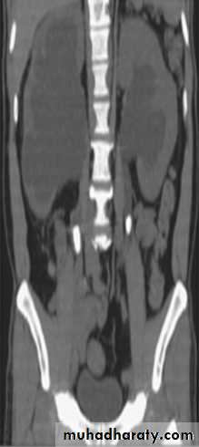 Genito-urinary System