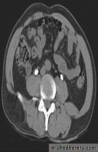 Genito-urinary System