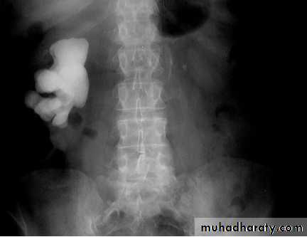 Genito-urinary System