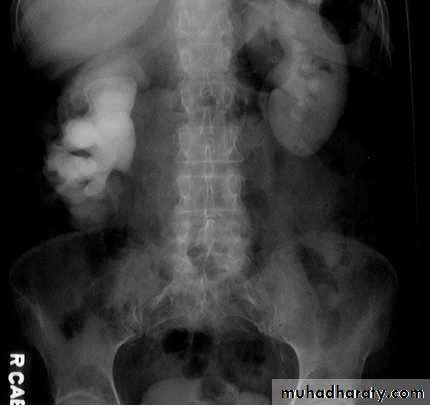 Genito-urinary System