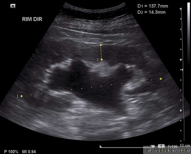 Genito-urinary System