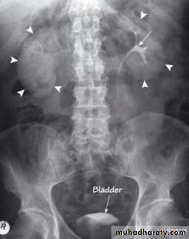 Genito-urinary System