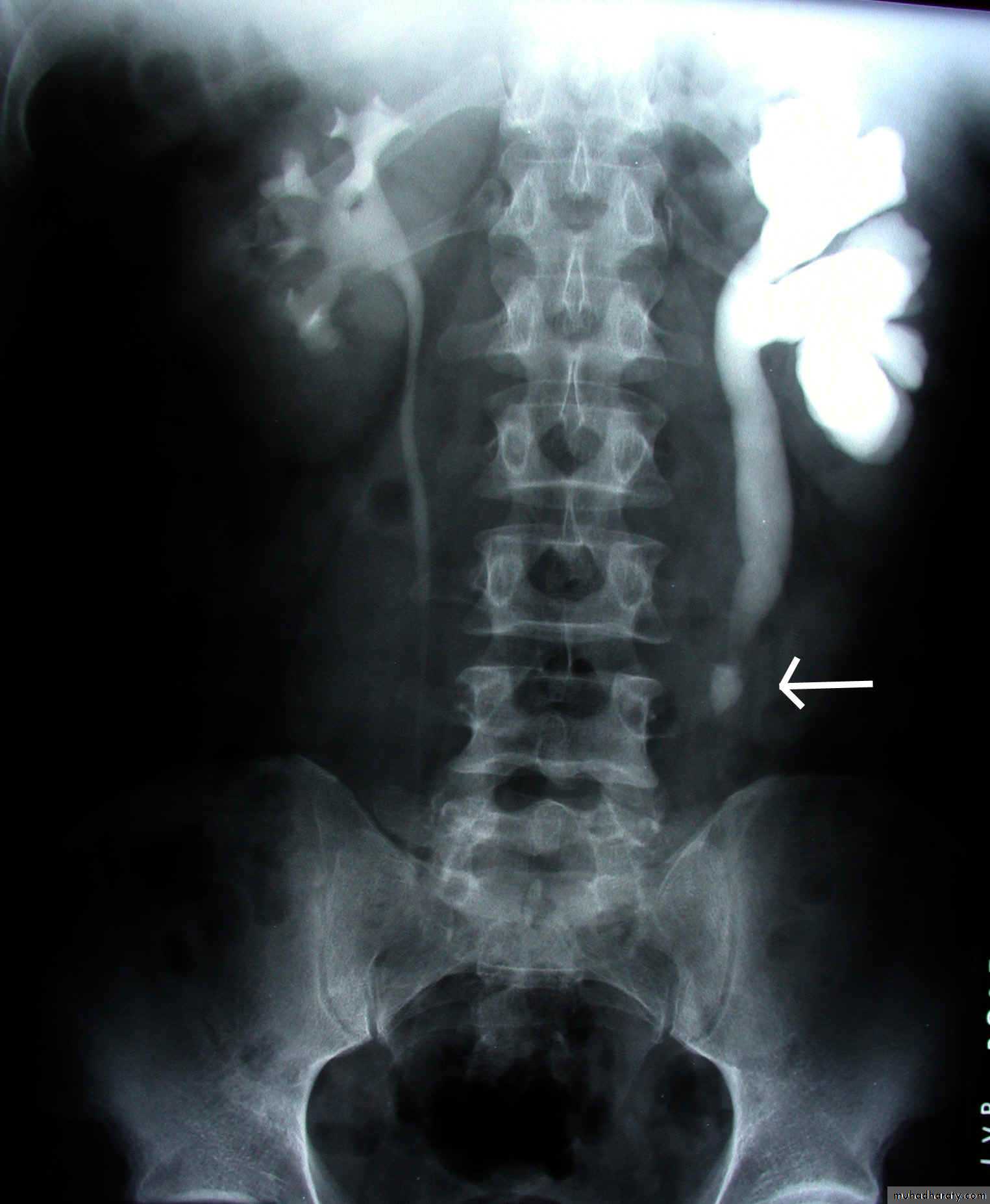 Genito-urinary System