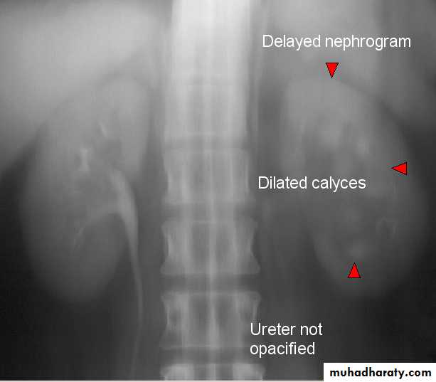 Genito-urinary System