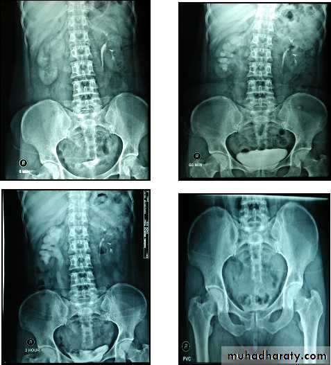 Genito-urinary System
