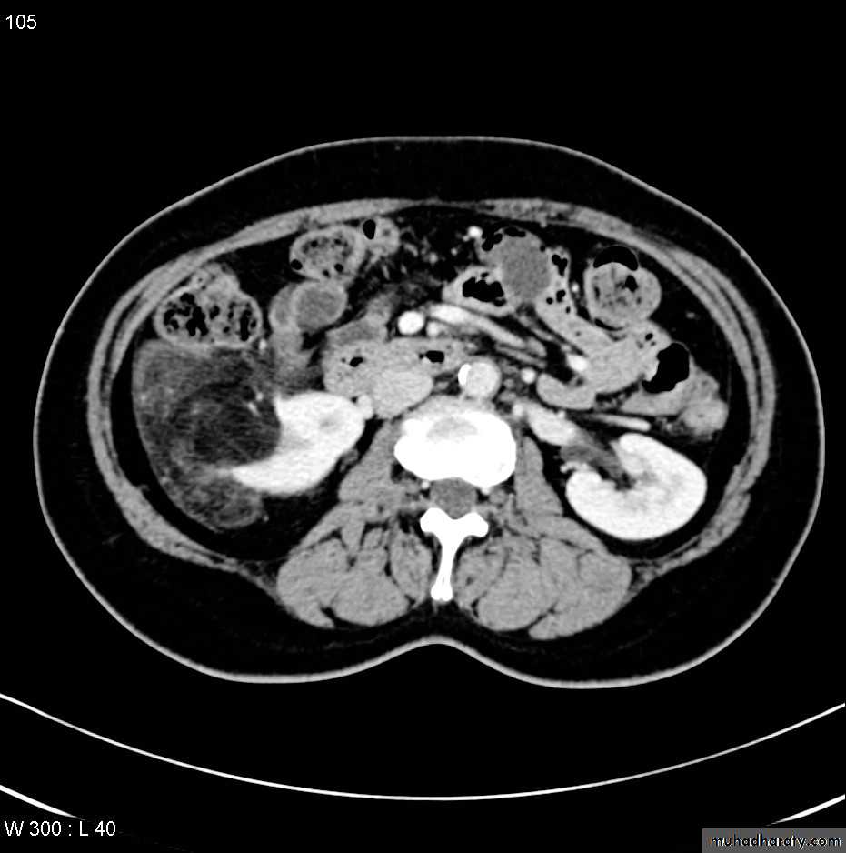 Genito-urinary System